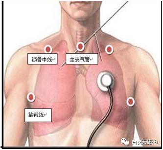 气管插管吸痰操作视频,气管插管吸痰操作视频详解