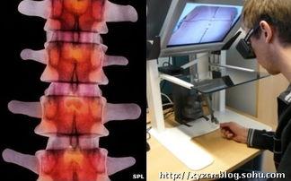 脊髓穿刺视频,视频直观展示